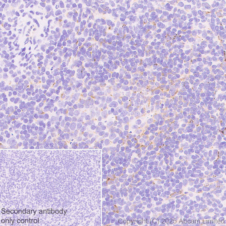 Immunohistochemistry (Formalin/PFA-fixed paraffin-embedded sections) - Anti-Clusterin antibody [RM1292] (AB323182)