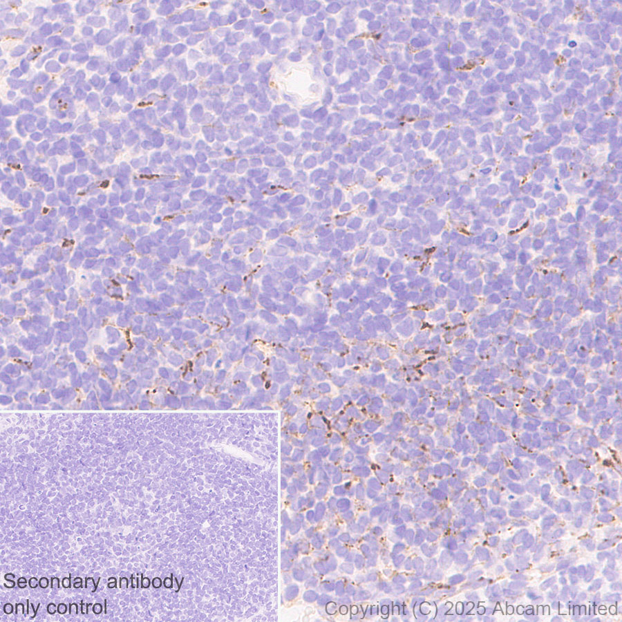 Immunohistochemistry (Formalin/PFA-fixed paraffin-embedded sections) - Anti-Clusterin antibody [RM1292] (ab323182), expandable thumbnail