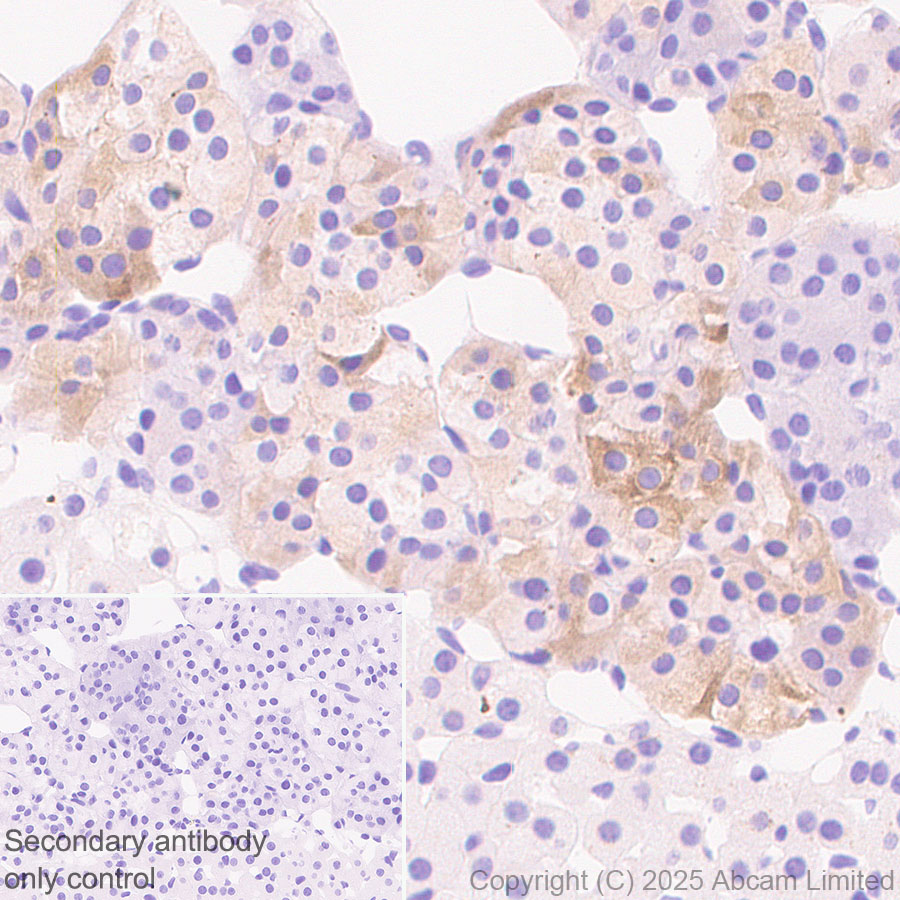Immunohistochemistry (Formalin/PFA-fixed paraffin-embedded sections) - Anti-Clusterin antibody [RM1292] (ab323182), expandable thumbnail
