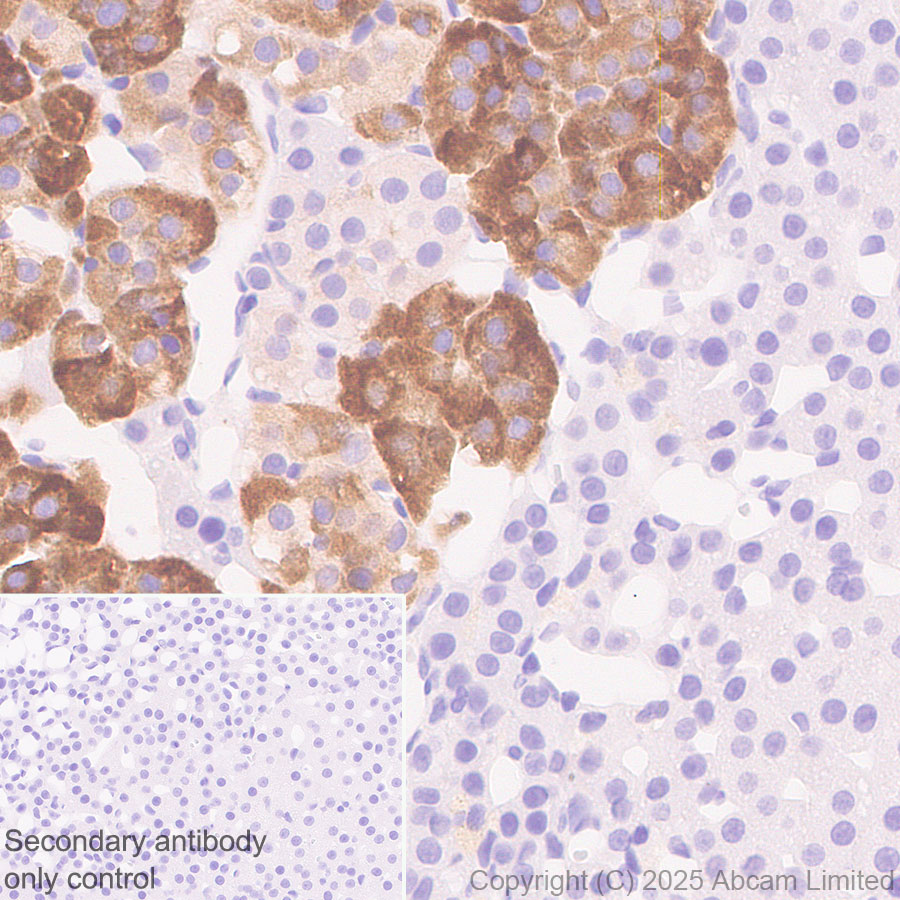 Immunohistochemistry (Formalin/PFA-fixed paraffin-embedded sections) - Anti-Clusterin antibody [RM1292] (ab323182), expandable thumbnail