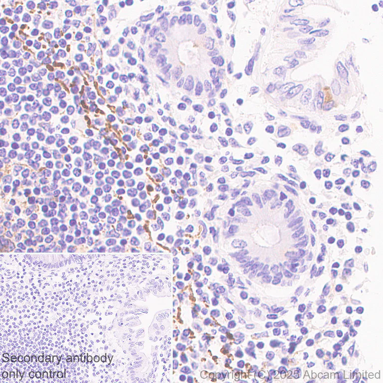 Immunohistochemistry (Formalin/PFA-fixed paraffin-embedded sections) - Anti-Clusterin antibody [RM1292] (AB323182)
