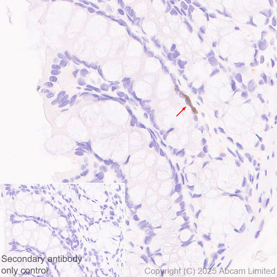 Immunohistochemistry (Formalin/PFA-fixed paraffin-embedded sections) - Anti-Clusterin antibody [RM1292] (ab323182), expandable thumbnail