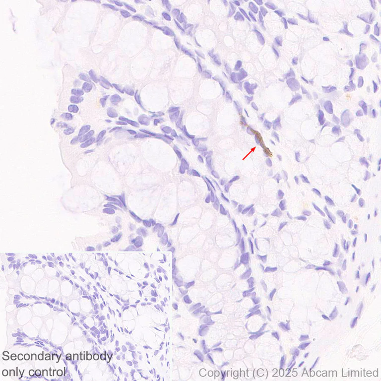 Immunohistochemistry (Formalin/PFA-fixed paraffin-embedded sections) - Anti-Clusterin antibody [RM1292] (AB323182)