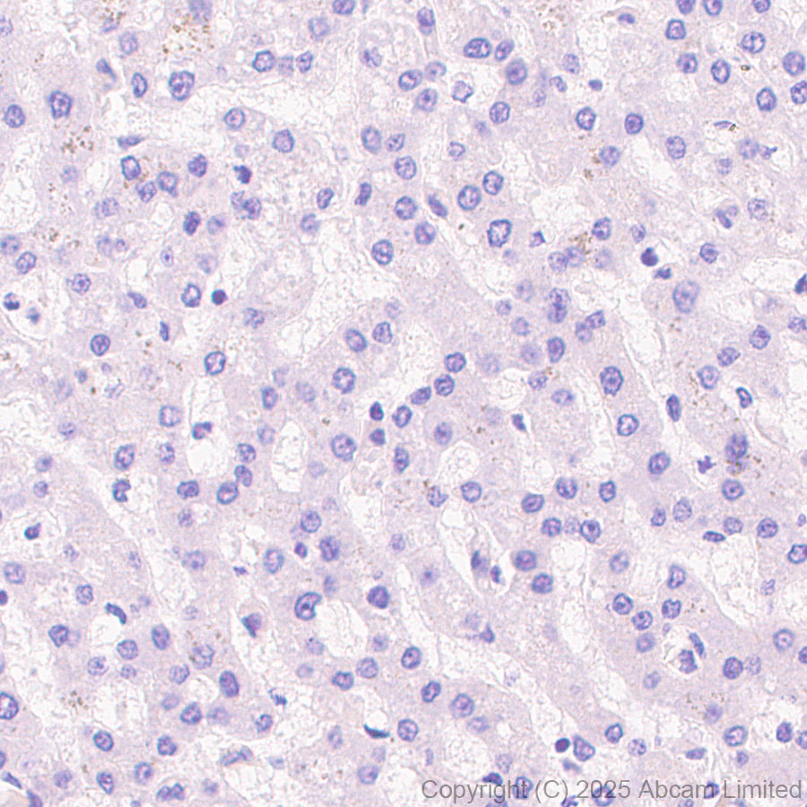 Immunohistochemistry (Formalin/PFA-fixed paraffin-embedded sections) - Anti-Clusterin antibody [RM1292] (ab323182), expandable thumbnail