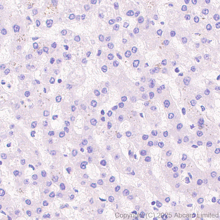 Immunohistochemistry (Formalin/PFA-fixed paraffin-embedded sections) - Anti-Clusterin antibody [RM1292] (AB323182)