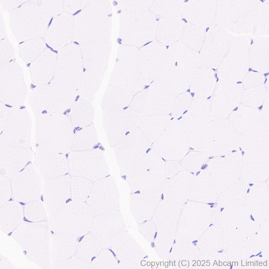 Immunohistochemistry (Formalin/PFA-fixed paraffin-embedded sections) - Anti-Clusterin antibody [RM1292] (AB323182), expandable thumbnail
