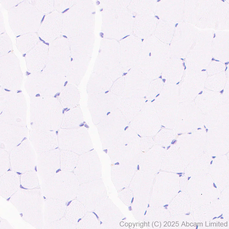 Immunohistochemistry (Formalin/PFA-fixed paraffin-embedded sections) - Anti-Clusterin antibody [RM1292] (AB323182)