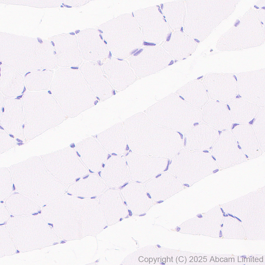 Immunohistochemistry (Formalin/PFA-fixed paraffin-embedded sections) - Anti-Clusterin antibody [RM1292] (AB323182), expandable thumbnail