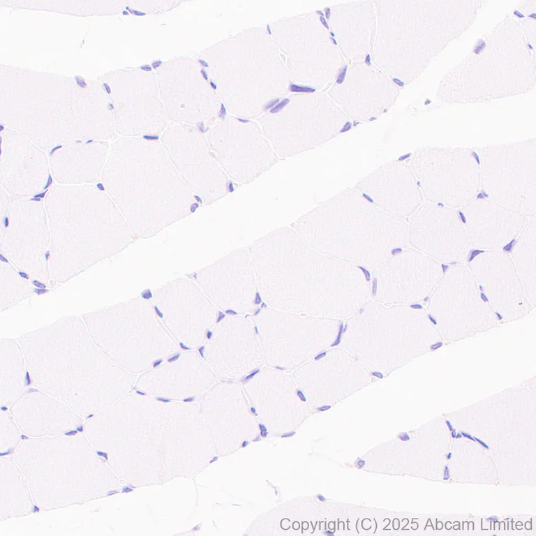 Immunohistochemistry (Formalin/PFA-fixed paraffin-embedded sections) - Anti-Clusterin antibody [RM1292] (AB323182)