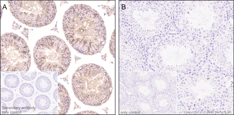 Immunohistochemistry (Formalin/PFA-fixed paraffin-embedded sections) - Anti-Clusterin antibody [RM1292] (AB323182)