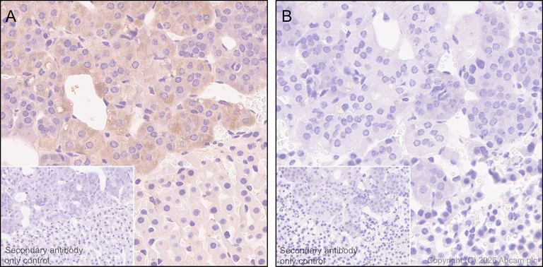 Immunohistochemistry (Formalin/PFA-fixed paraffin-embedded sections) - Anti-Clusterin antibody [RM1292] (AB323182)