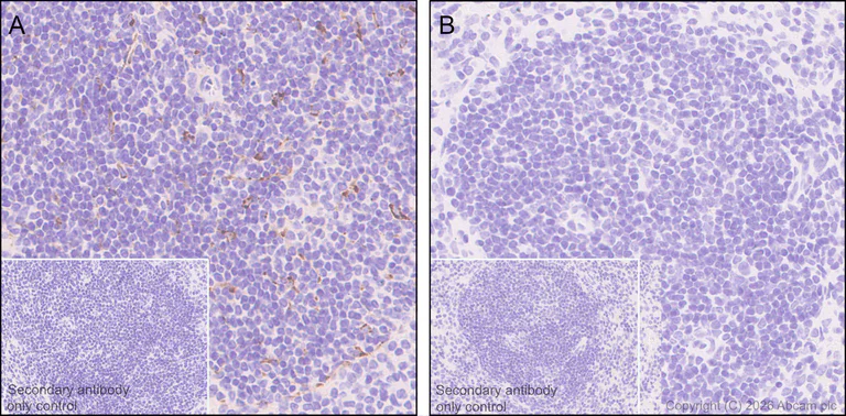 Immunohistochemistry (Formalin/PFA-fixed paraffin-embedded sections) - Anti-Clusterin antibody [RM1292] (AB323182)