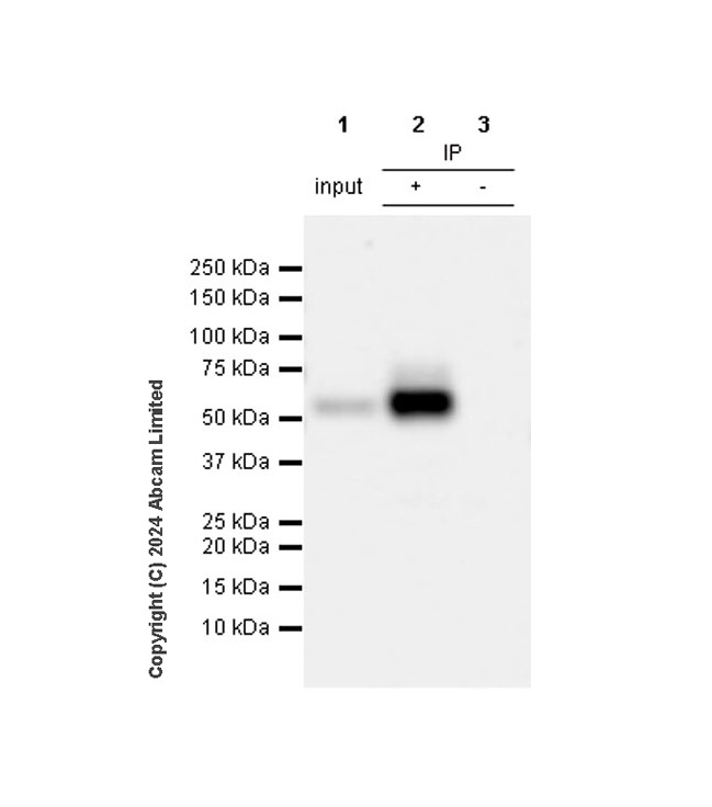 Immunoprecipitation - Anti-Clusterin antibody [RM1292] (AB323182), expandable thumbnail
