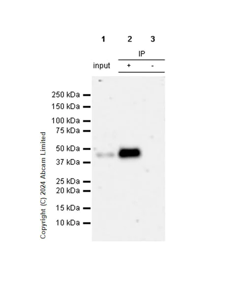 Immunoprecipitation - Anti-Clusterin antibody [RM1292] (AB323182)