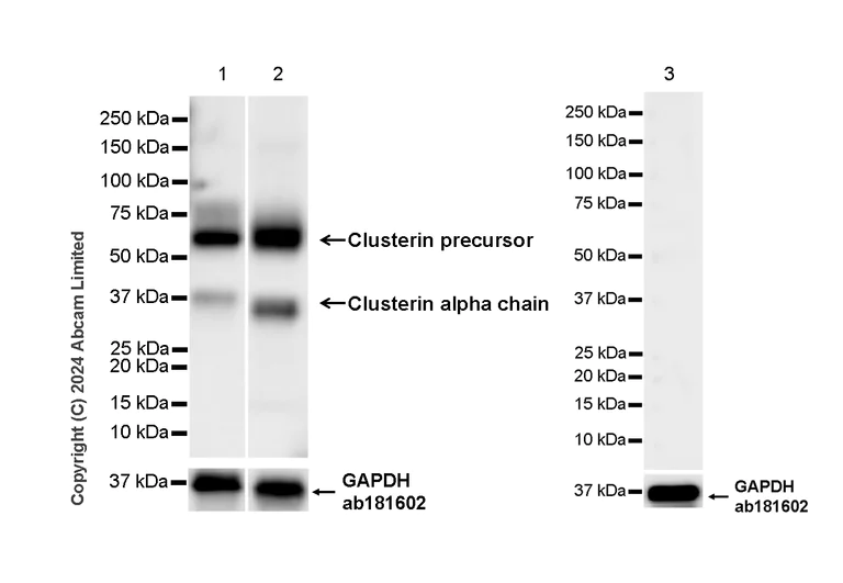 Western blot - Anti-Clusterin antibody [RM1292] (AB323182)