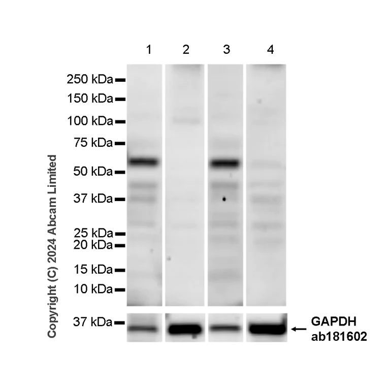 Western blot - Anti-Clusterin antibody [RM1292] (AB323182)