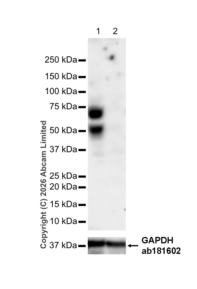 Western blot - Anti-Clusterin antibody [RM1292] (AB323182)