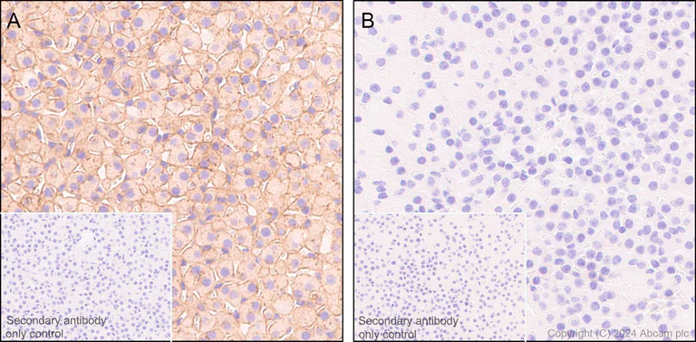 Immunohistochemistry (Formalin/PFA-fixed paraffin-embedded sections) - Anti-Clusterin beta chain antibody [EPR17538-101] (AB184099)