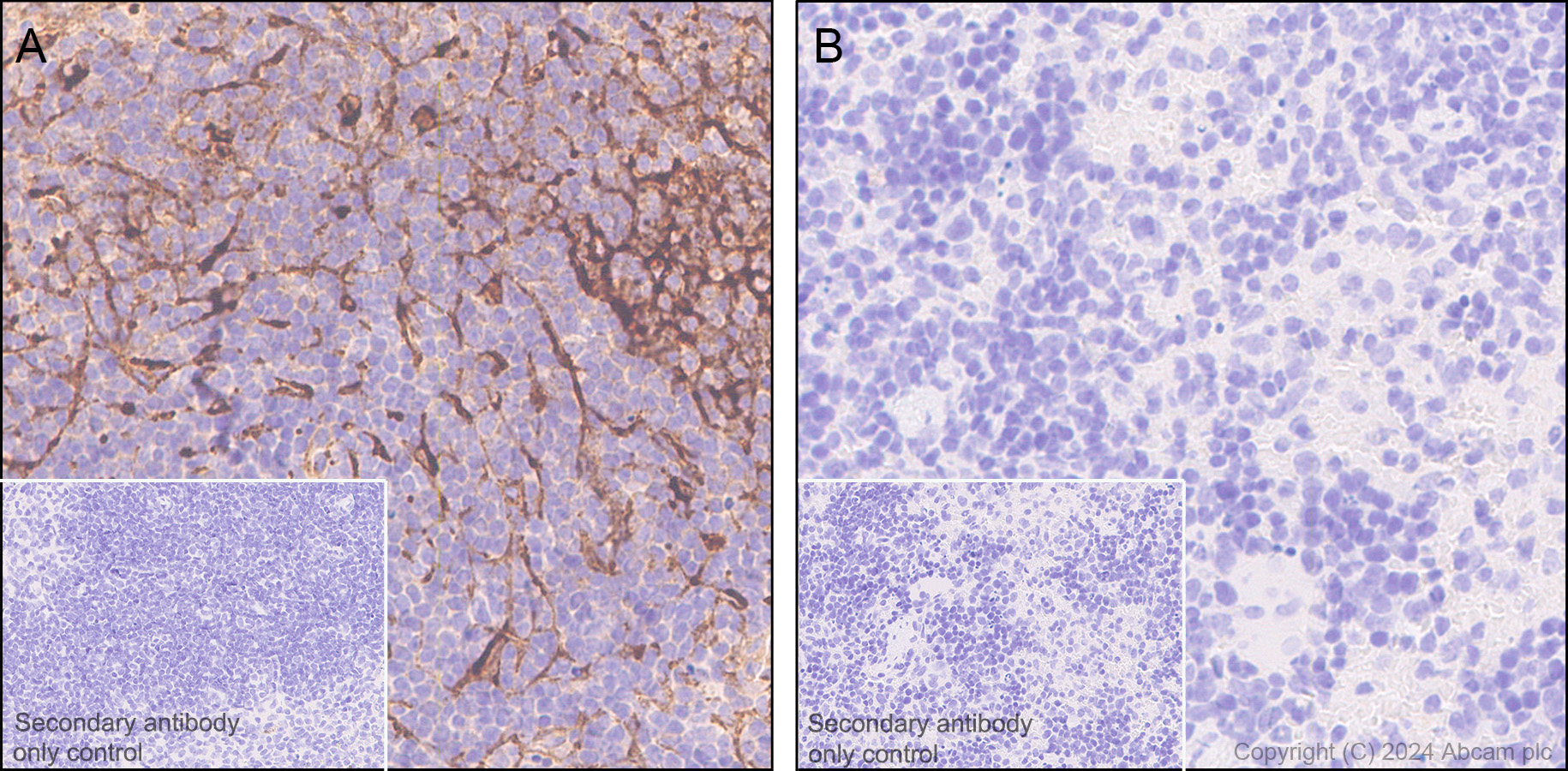Immunohistochemistry (Formalin/PFA-fixed paraffin-embedded sections) - Anti-Clusterin beta chain antibody [EPR17538-101] (ab184099), expandable thumbnail