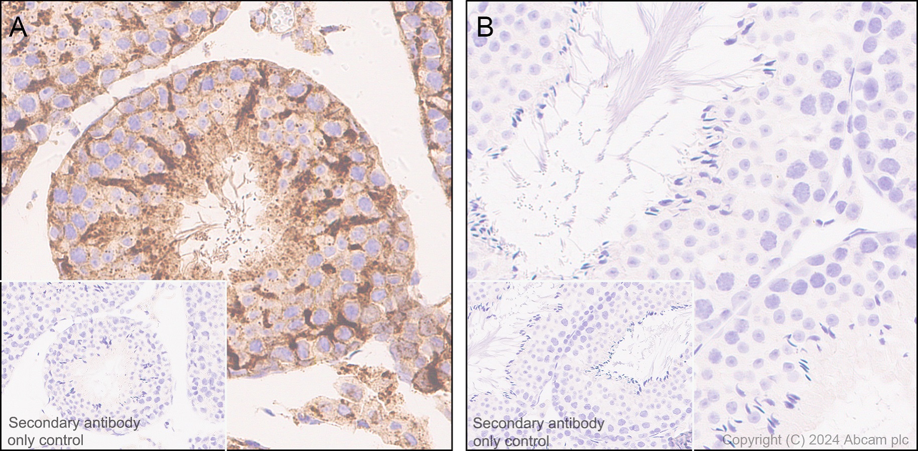 Immunohistochemistry (Formalin/PFA-fixed paraffin-embedded sections) - Anti-Clusterin beta chain antibody [EPR17538-101] (ab184099), expandable thumbnail