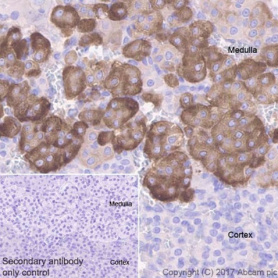 Immunohistochemistry (Formalin/PFA-fixed paraffin-embedded sections) - Anti-Clusterin beta chain antibody [EPR17538-101] (AB184099), expandable thumbnail