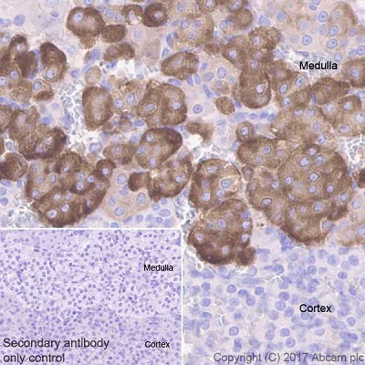 Immunohistochemistry (Formalin/PFA-fixed paraffin-embedded sections) - Anti-Clusterin beta chain antibody [EPR17538-101] (AB184099)