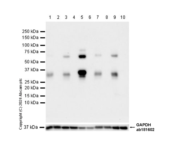 Western blot - Anti-Clusterin beta chain antibody [EPR17538-101] (AB184099), expandable thumbnail