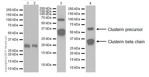 Western blot - Anti-Clusterin beta chain antibody [EPR17538-101] (AB184099), expandable thumbnail