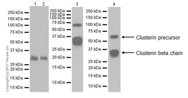 Western blot - Anti-Clusterin beta chain antibody [EPR17538-101] (AB184099)