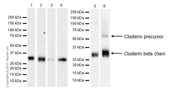 Western blot - Anti-Clusterin beta chain antibody [EPR17538-101] (AB184099), expandable thumbnail