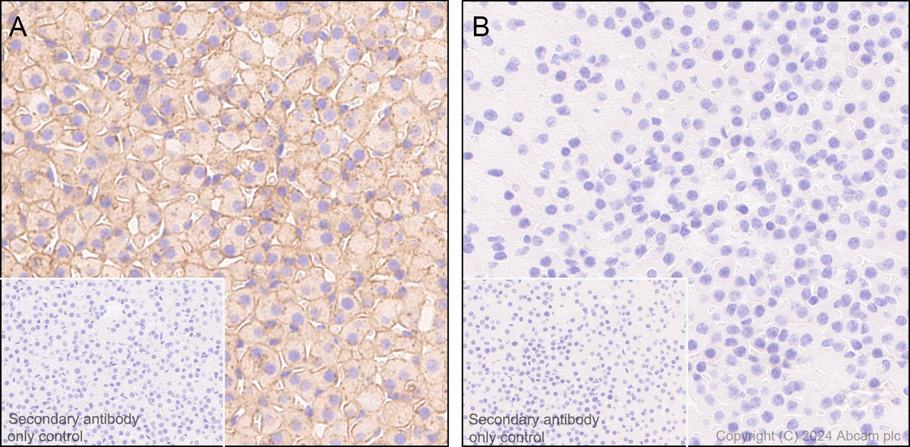 Immunohistochemistry (Formalin/PFA-fixed paraffin-embedded sections) - Anti-Clusterin beta chain antibody [EPR17538-101] - BSA and Azide free (AB229127)