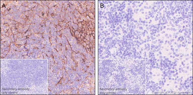 Immunohistochemistry (Formalin/PFA-fixed paraffin-embedded sections) - Anti-Clusterin beta chain antibody [EPR17538-101] - BSA and Azide free (AB229127)