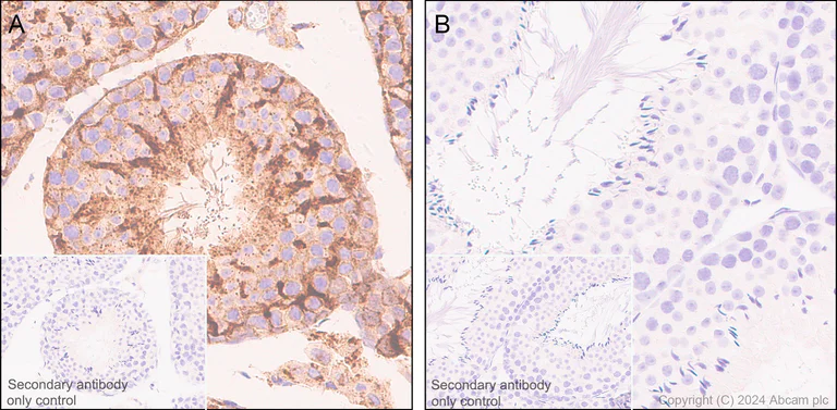 Immunohistochemistry (Formalin/PFA-fixed paraffin-embedded sections) - Anti-Clusterin beta chain antibody [EPR17538-101] - BSA and Azide free (AB229127)
