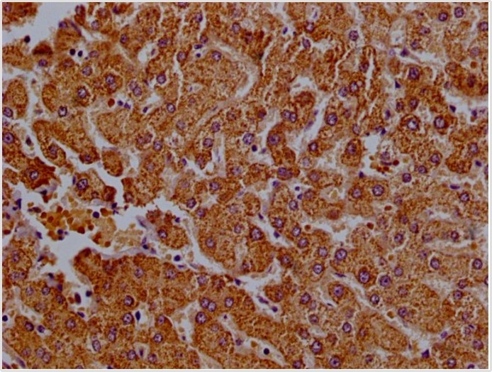 Immunohistochemistry (Formalin/PFA-fixed paraffin-embedded sections) - Anti-CLYBL/CLB antibody (AB235434), expandable thumbnail
