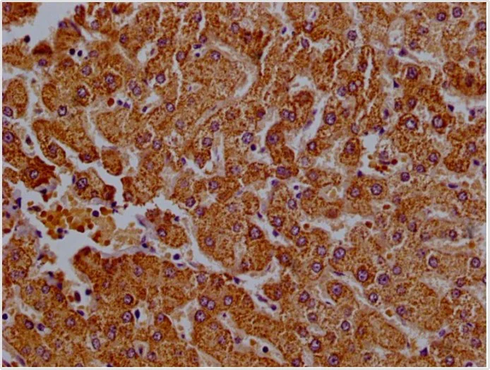 Immunohistochemistry (Formalin/PFA-fixed paraffin-embedded sections) - Anti-CLYBL/CLB antibody (AB235434)