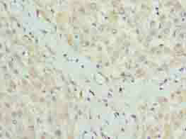 Immunohistochemistry (Formalin/PFA-fixed paraffin-embedded sections) - Anti-CLYBL/CLB antibody (AB235434), expandable thumbnail
