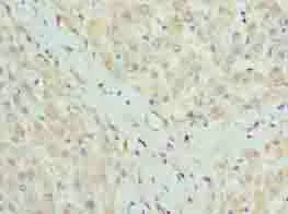 Immunohistochemistry (Formalin/PFA-fixed paraffin-embedded sections) - Anti-CLYBL/CLB antibody (AB235434)