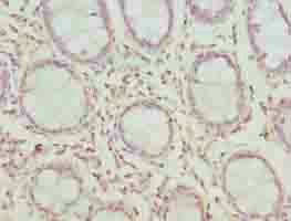 Immunohistochemistry (Formalin/PFA-fixed paraffin-embedded sections) - Anti-CLYBL/CLB antibody (ab235434), expandable thumbnail