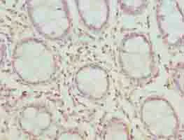 Immunohistochemistry (Formalin/PFA-fixed paraffin-embedded sections) - Anti-CLYBL/CLB antibody (AB235434)