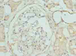 Immunohistochemistry (Formalin/PFA-fixed paraffin-embedded sections) - Anti-CLYBL/CLB antibody (AB235434), expandable thumbnail