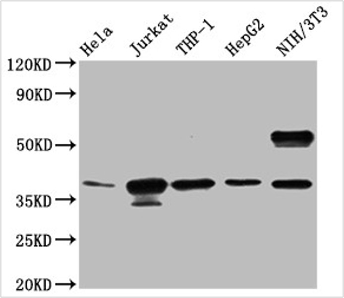 Western blot - Anti-CLYBL/CLB antibody (AB235434), expandable thumbnail