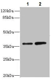 Western blot - Anti-CLYBL/CLB antibody (AB235434)