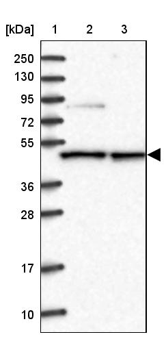 Western blot - Anti-CMAS antibody (AB254648)