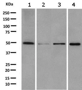 Western blot - Anti-CMAS antibody [EPR10485] (AB157189)