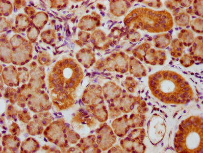 Immunohistochemistry (Formalin/PFA-fixed paraffin-embedded sections) - Anti-CMIP antibody (AB237049)