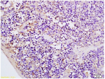 Immunohistochemistry (Formalin/PFA-fixed paraffin-embedded sections) - Anti-CMKLR1 antibody (AB203384)