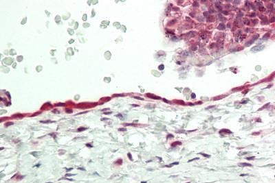 Immunohistochemistry (Formalin/PFA-fixed paraffin-embedded sections) - Anti-CMKLR1 antibody (AB230442)