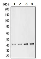 Western blot - Anti-CMKLR1 antibody (AB230442)