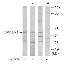Western blot - Anti-CMKLR1 antibody (AB64881)