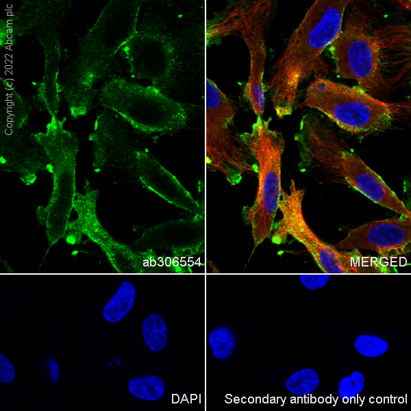 Immunocytochemistry/ Immunofluorescence - Anti-CMKLR1 antibody [EPR26501-70] (ab306554), expandable thumbnail